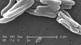 Advances in tuberculosis control during the past decade 